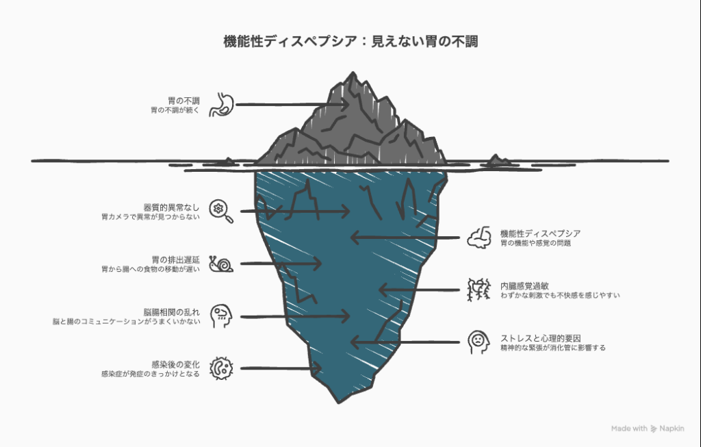 胃カメラで異常なし、それでも症状が続くとき-機能性ディスペプシアと診断された後に知っておきたいこと-